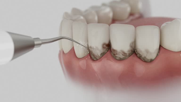 Reliable Dental contractor in Monon, IN by Dentist Open Now